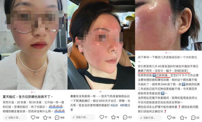 做好防晒也挡不住“热老化”：止住夏日皮肤红热烫多做1步就够(图2)